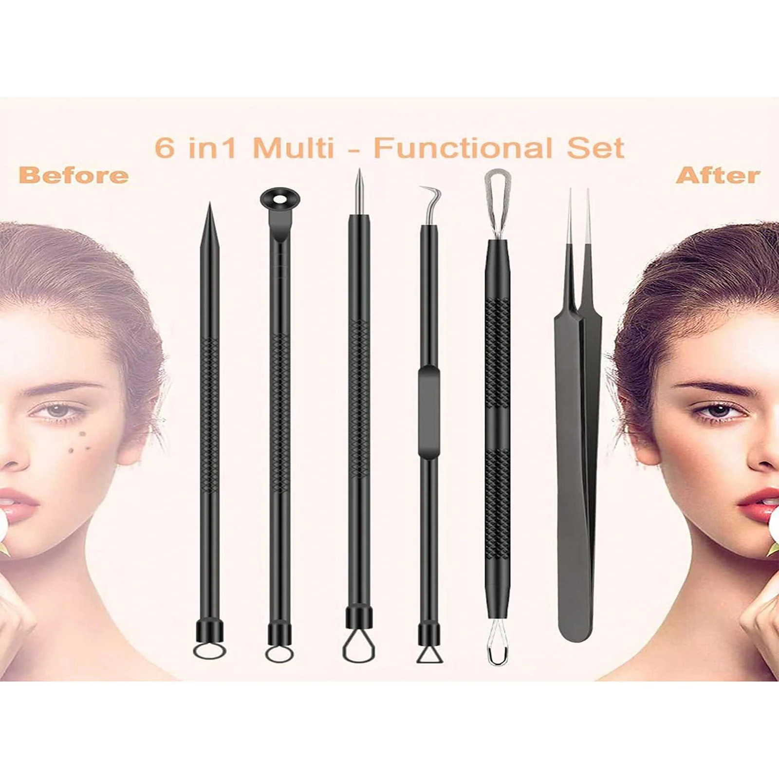 6 Piece Blackhead Acne Removal Kit Acne Blackhead Removal Needle Stainless Steel Set Tools Facial Skin Care Cleansing acne blackhead removal tool