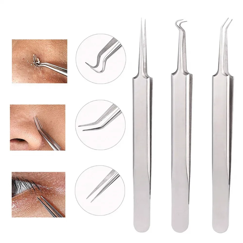 German Ultra-fine No. 5 Cell Pimples Blackhead Clip Tweezers Beauty Salon Special Scraping & Closing Artifact Acne Needle Tools precision tweezers tweezer tool pimples blackhead tweezers blackhead clip tweezers cosmetic tool