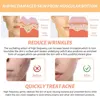 4 In 1 Electrode Wand High Frequency Electrotherapy Glass Tube Beauty Device Acne Spot Remover Facial Anti Wrinkle Skin Care Spa 5