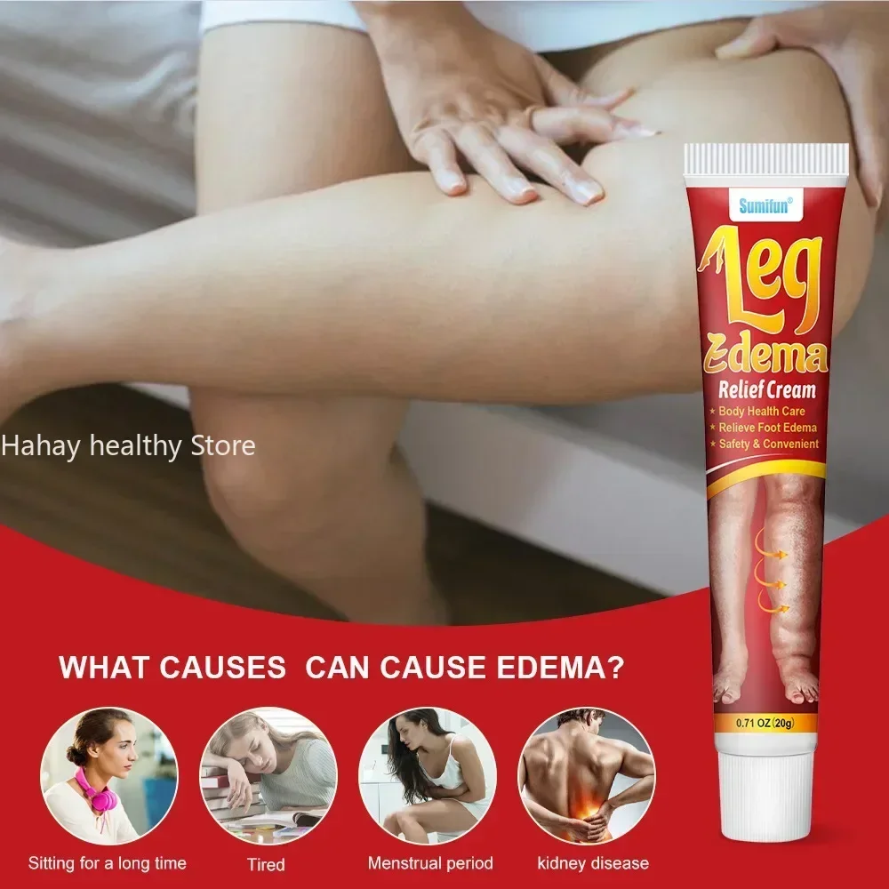 Leg Repair Pen Improving Blood Circulation Varicose Veins Relieves Leg Bulge Discomfort Cream Skin Body Health Care