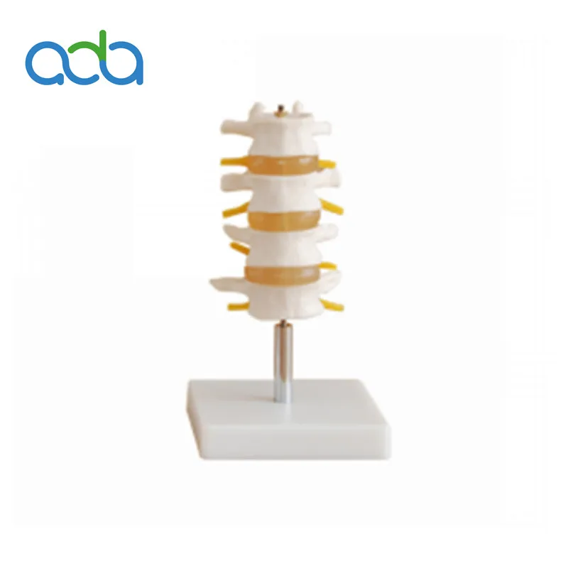 

Обычная комбинация поясничных позвонков (четыре секции)