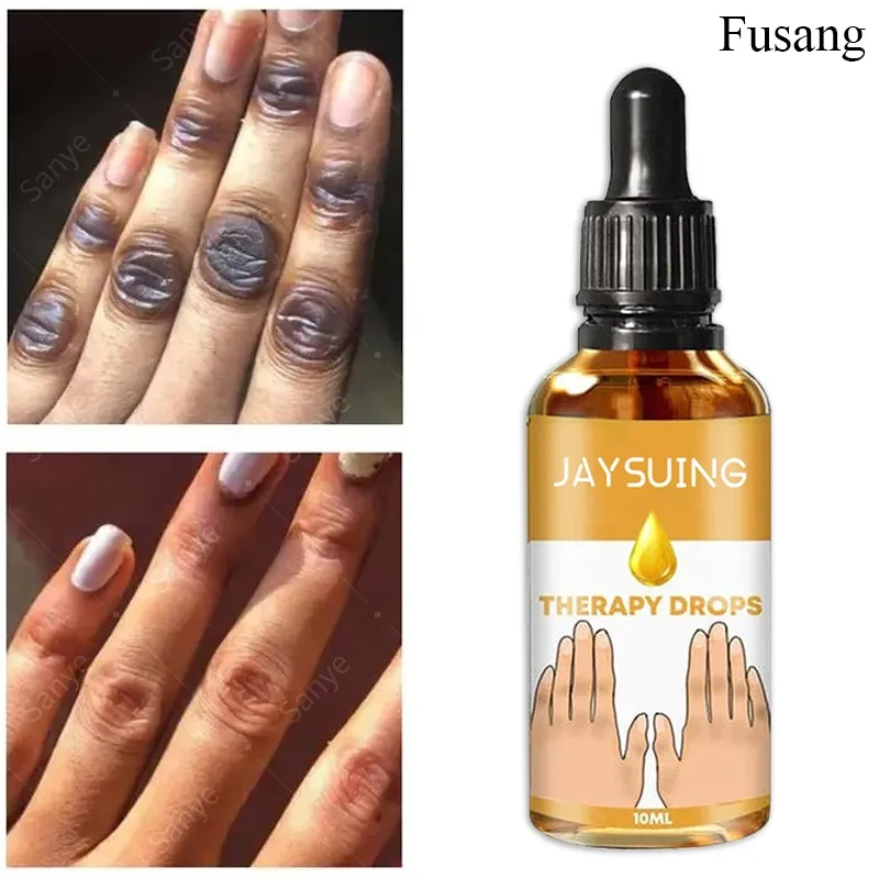 Niacinamide Body Whitening Serum Dark Knuckle Brightening Essence Lotion Hand Remove Dark Spots Serum Knuckle Elbow Knee Whiten