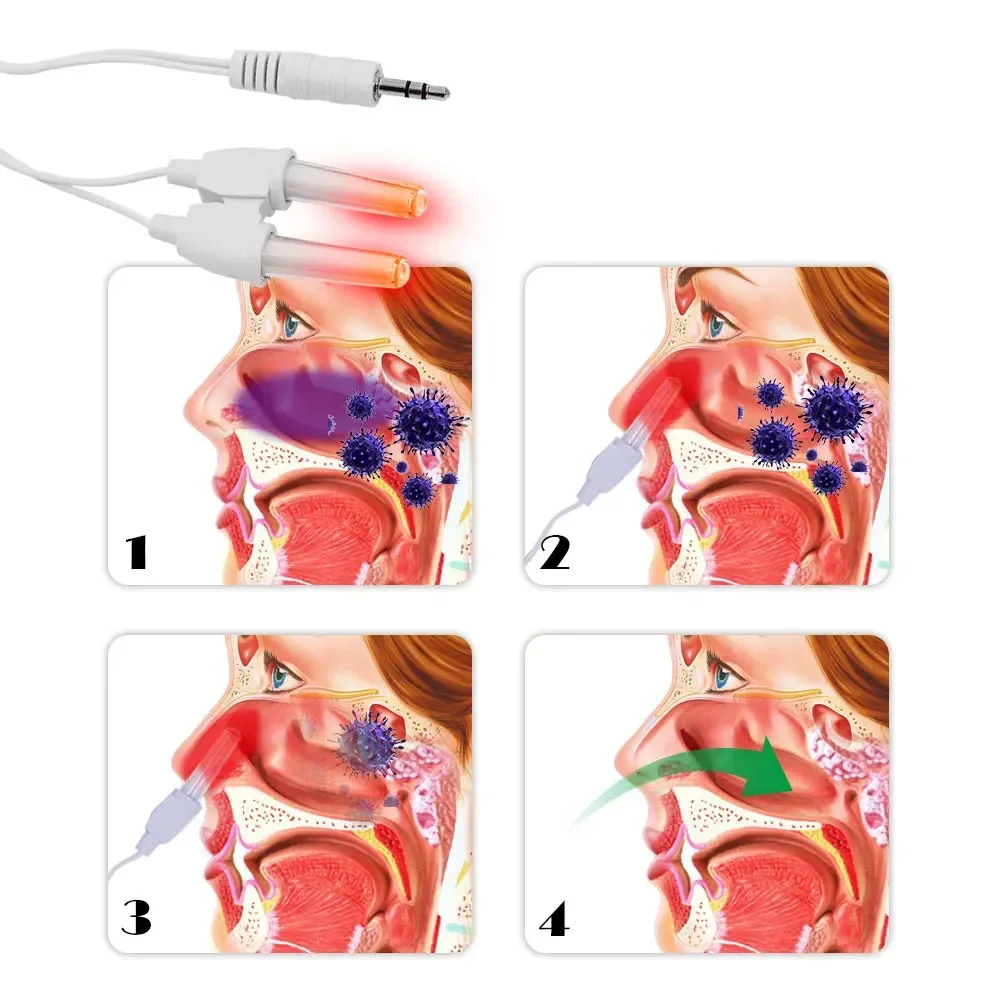 BioNase Rhinitis Therapeutic Instrument Painless Laser Low Frequency Nose Cure Health Care Therapy Massage Device