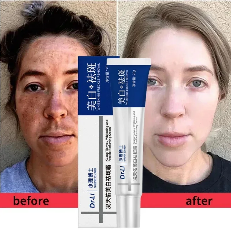 

Dr. Li Freckle Whitening Cream Fade Dark Spot Brightening Black Dot Melasma Chloasma Removal Smooth Tender Moisturizer Skin Care