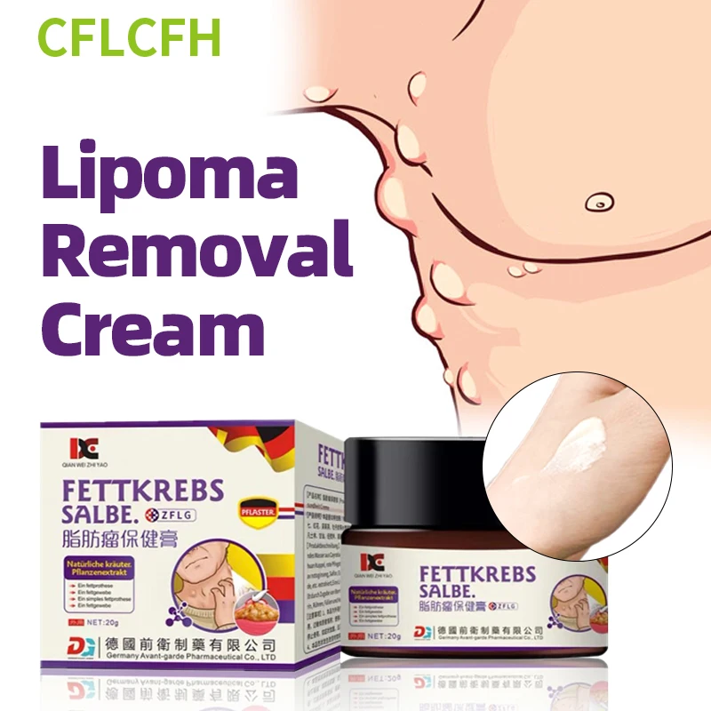 

Lipoma Removal Cream Fibroma Cellulite Remover Fat Lump Lipomas Cyst Medicine Fat Mass Treatment Patch German Secret Recipe