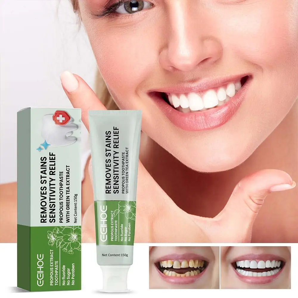 

Propolis Extract Toothpaste Cleaning Repair Cavities Plaque Odors Propolis Caries Removal Stains Oral Yellowing Reduce T3m2