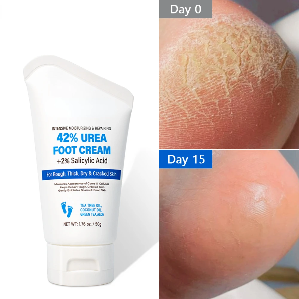 

Urea Exfoliator Foot Cream Dead Skin Remover Crack Heel Moisturizing Treatment Exfoliation Feet Hand Creams Skin Care Products