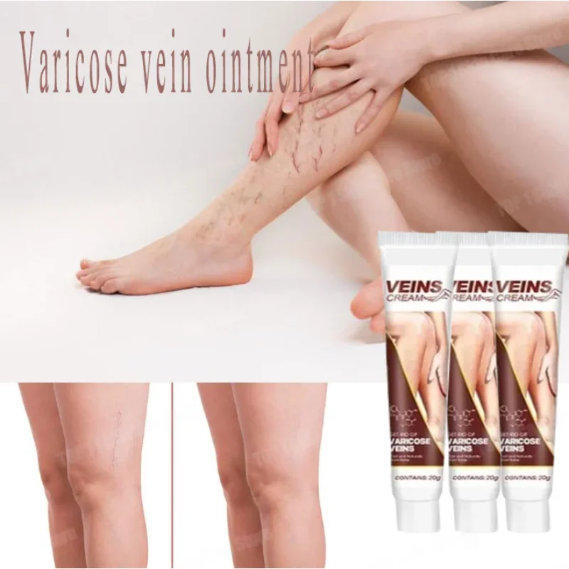 Safe and effective varicose vein removal Effective treatment of vasculitis Fast treatment of leg varicose vein removal Fast