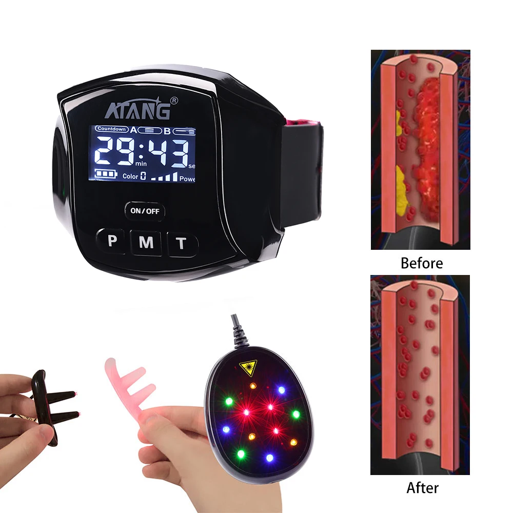 Physical Rehabilitation Lllt Laser Wrist Semiconductors 650nm Diode Acupuncture Diabetes Therapy Watch