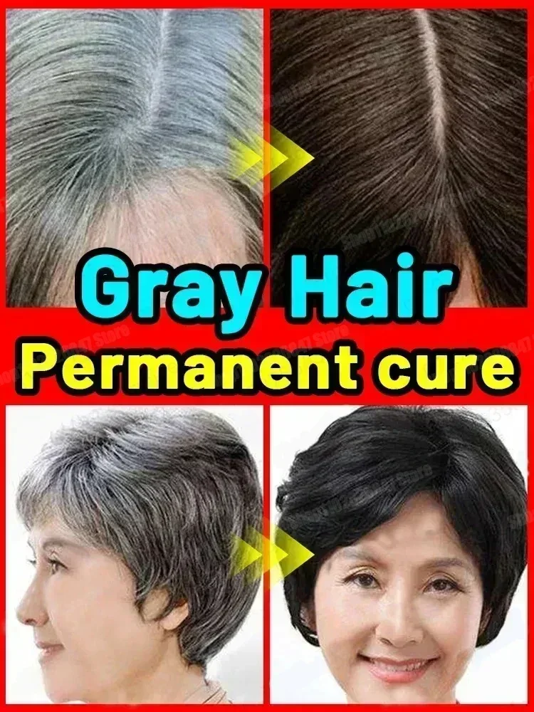 Natural  and Healthy White To Black hair  Anti-grey hair essence Serum 4