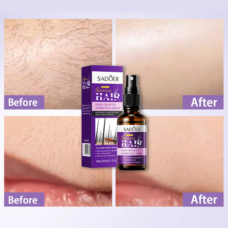

Hair Removal Cream Inhibits Hair Growth Effectively Remove Armpit Knee Leg Hair Whitening Safe Gentle Spray Skincare Products