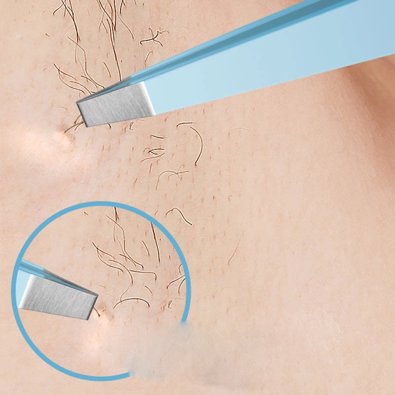 눈썹 족집게 다채로운 색상의 미세 모발 제거기 스테인리스 스틸 사선 눈썹 클립 제모 메이크업 도구
