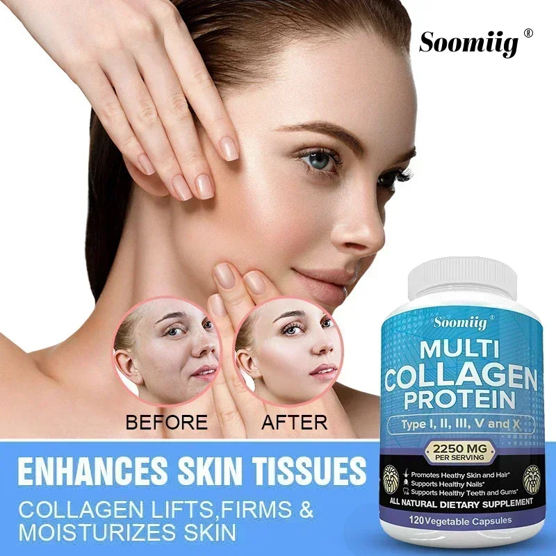 Super Collagen Peptides Multi-Collagen Protein Gluten Free Non-GMO Grass Fed Good for Hair Skin Nails Teeth Gums Joints collagen supplements
