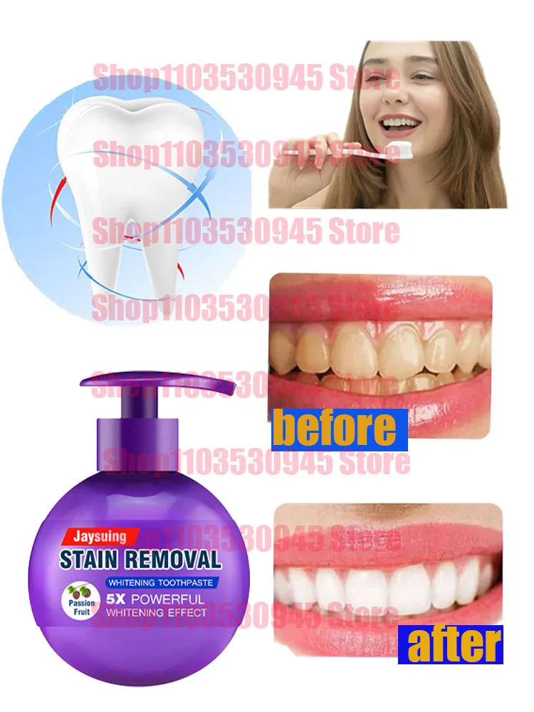 

baking soda nicotinamide whitening and yellowing care gum toothpaste fresh oral tooth paste