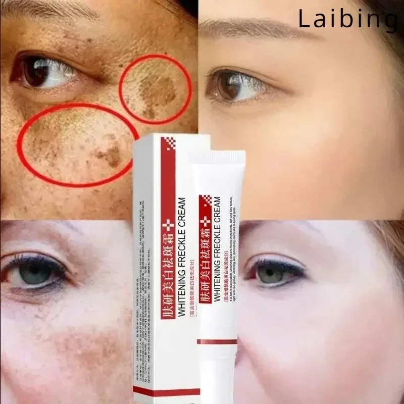 

Cleansing Melasma Cream Reduces Melanin and Improves Dry Dull for Women Replenishing Facial Moisture Skin Lifting Care Cream
