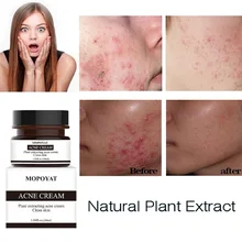 

Herbal Day Cream For Acne Skin Care Face Moisturizer Oil Control Pimple Acne Scar Removal Cream Treatment For Women