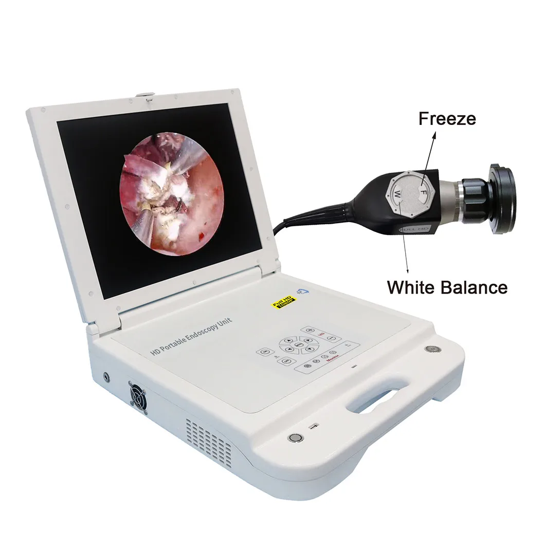 

Medical Multi Function Endoscopy System Portable ENT HD 1080P Endoscope Unit