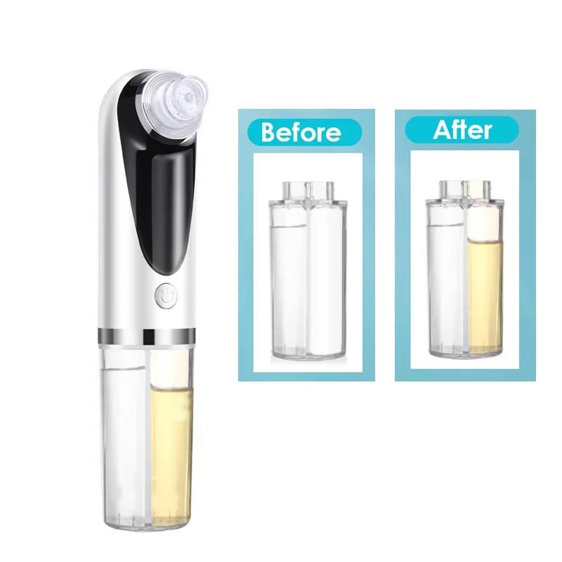 Blackhead Remover Blackhead Remover Pore Vacuum FaceCleaner Electric Pimple Acne Black HeadRemoval USB Rechargeable Water CycleBlack Dot Remove