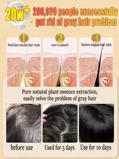 Tueur de cheveux blancs, &eacute;limine les cheveux gris et restaure la couleur naturelle en 7 jours