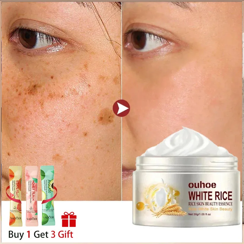 White Rice Whitening Face Cream Remove Dark Spots Fade Freckle Melanin Anti Wrinkle Aging Moisturizing Brighten Skin Care New