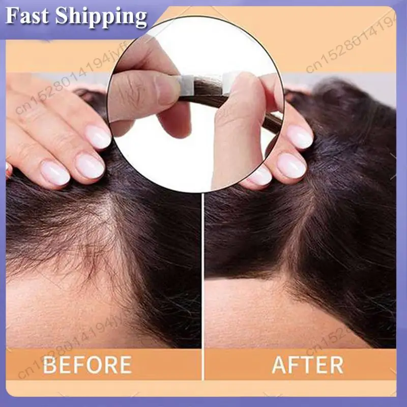 -ABDH 72Pc Uultra Huld 가발 테이프 이중 접착 헤어 익스텐션 테이프 스트립 Toupee 레이스 프론트 가발 필름 방수