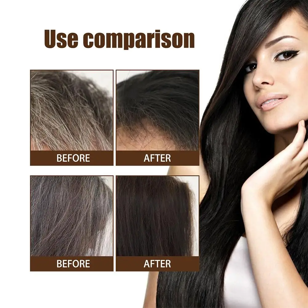 Reverse Grey Hair Treatmnt Serum Anti Hair Loss Spray Men Women Hair Care Black Hair Spray Essence For Healthy Hair