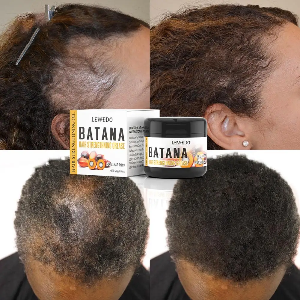 

Batana Oil For Hair Growth Batana Oil Butter Hair Treatment Dry Hair Split Ends Smooth Hair Anti Hair Loss Batana Oil D5B0