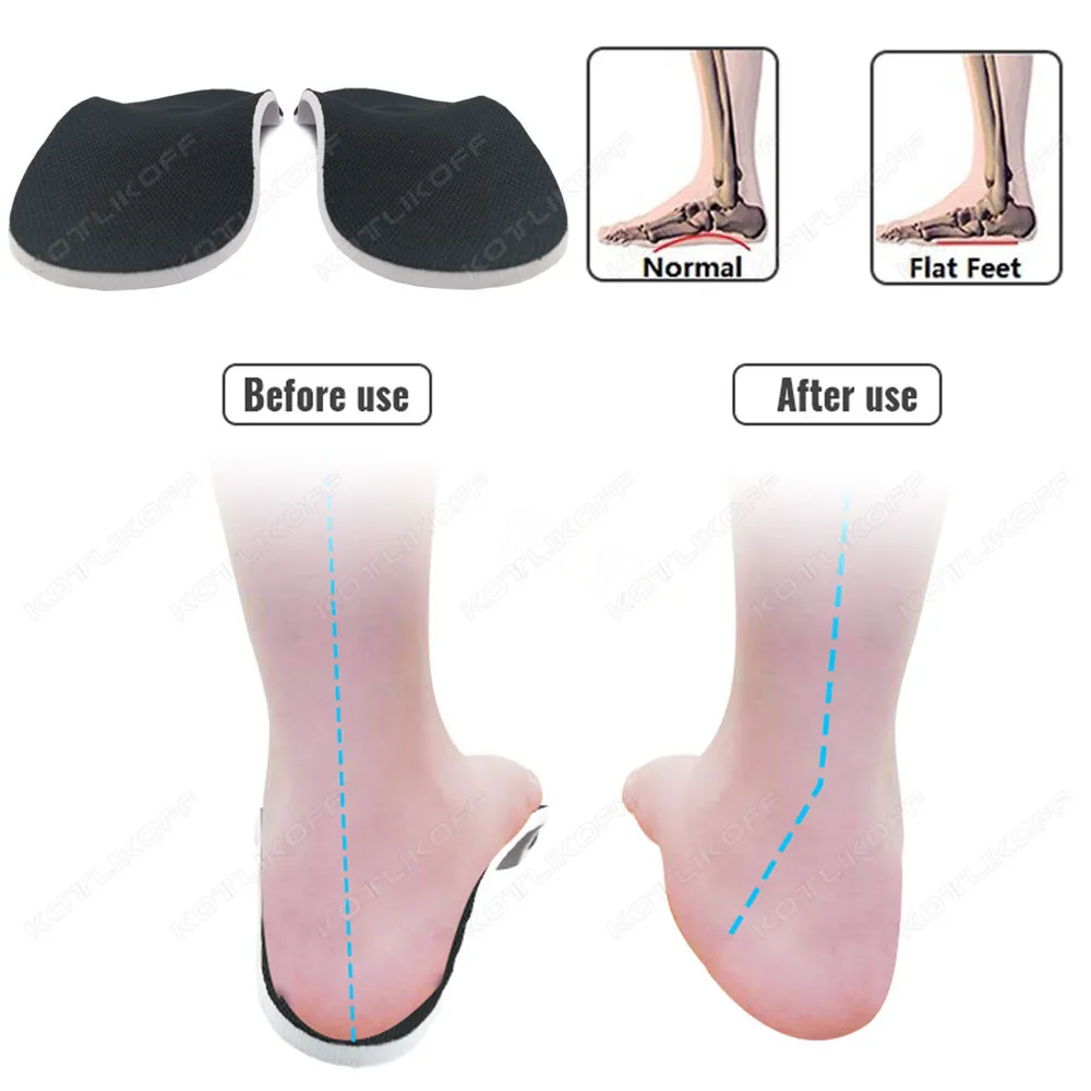 รูปสินค้า แผ่นรองเท้า Gel 3D รองรับเท้าสูง ใส่สบายทั้งวัน