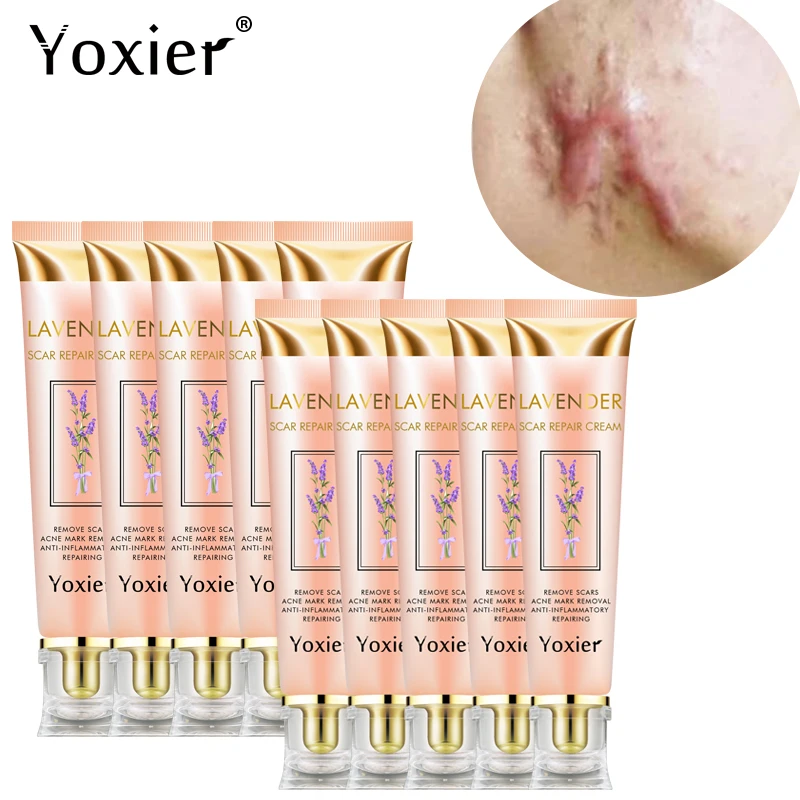 Yoxier 10pcs Repair Scar Cream Acne Scar Stretch Marks Pigmentation