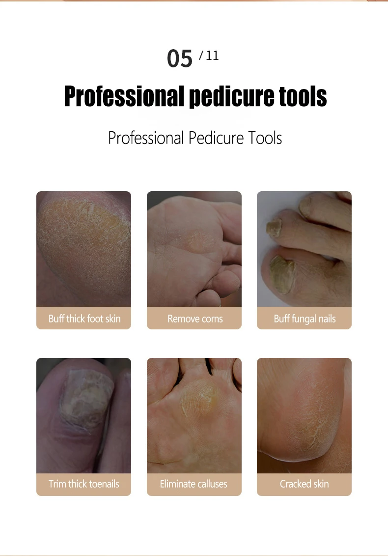 Râpe électrique pour les pieds dissolvant callosités pédicure_voghion.com