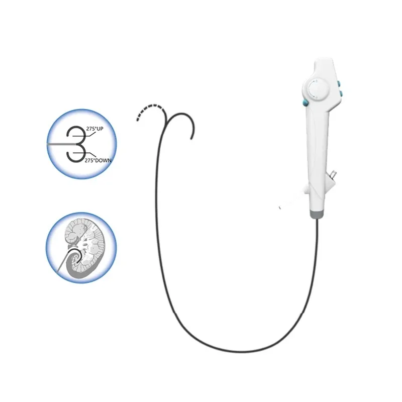 

Euprun Urology Single Use Digital Video Flexible Ureteroscope Price Disposable Portable