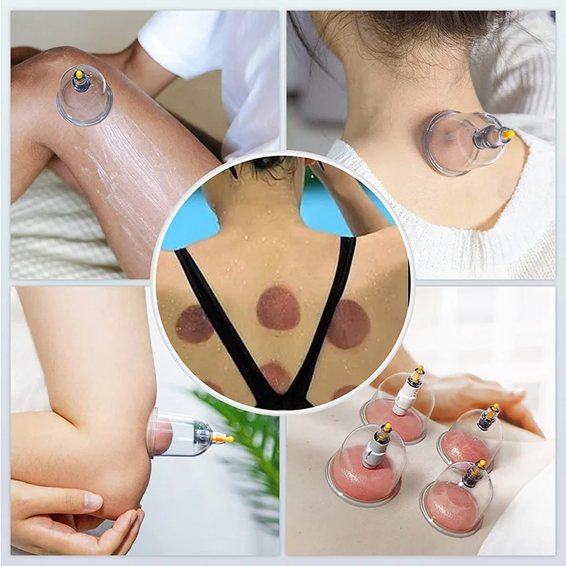 6or24  Pieces Suction Cups Massage Vacuum Cupping Body Massager Plastic Vacuum Suction Therapy Cupping Set Cans for Massage 6
