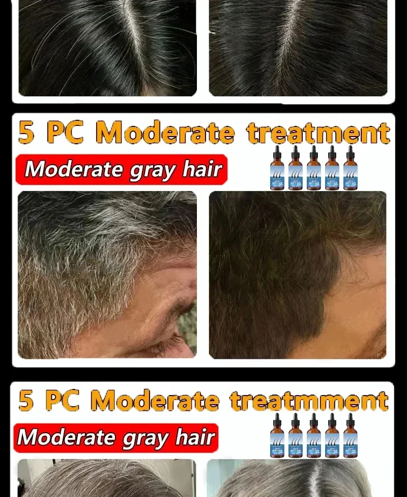 restauration de la couleur naturelle des cheveux et restauration de la sant&eacute; des cheveux blancs au noir