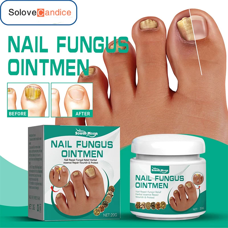 Nail Fungus Treatments Serum Cream Anti Infection Onychomycosis Paronychia Care Ointment Anti