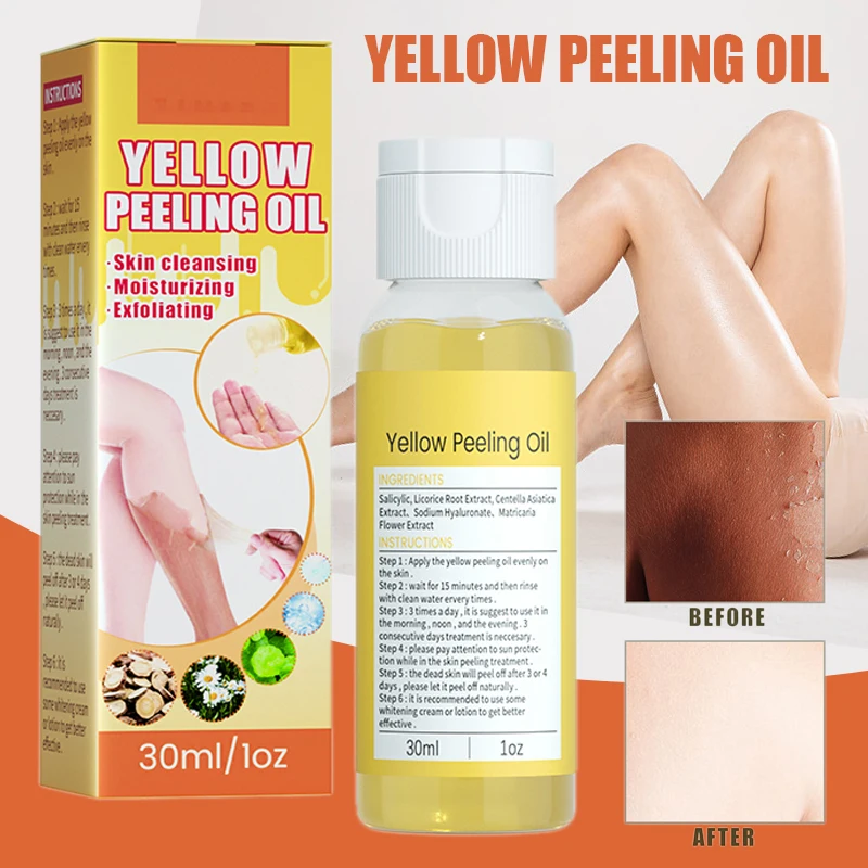 

1 Pc 30ml Strong Yellow Peeling Oil Exfoliating Solution Bleaching Dark Skin Spots Blackheads for Body Face Skin Care Beauty