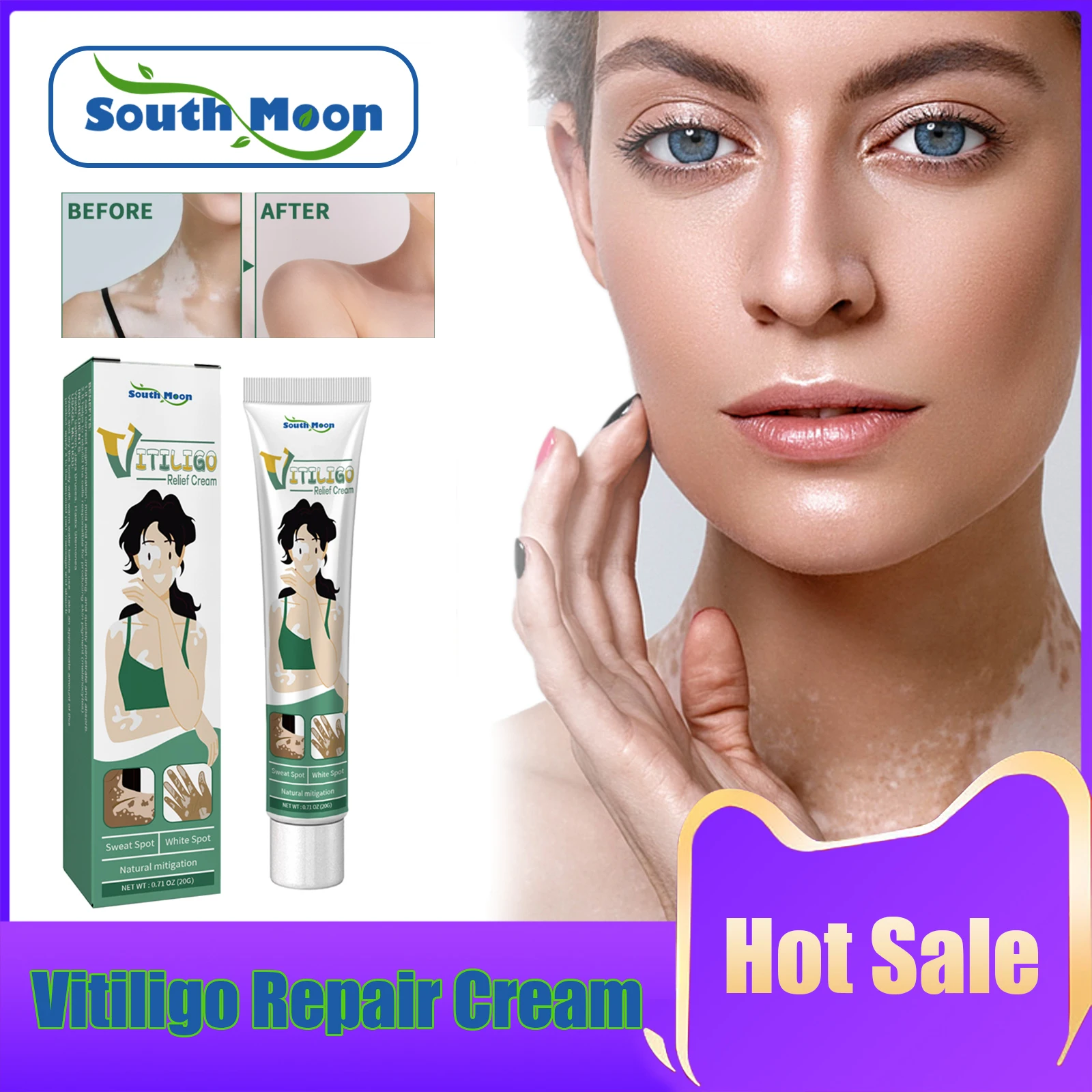 

Vitiligo Treatment Cream Remove Ringworm Psoriasis Leukoplakia Disease Repair Mycosis Anti-inflammatory White Spot Ointment 20g
