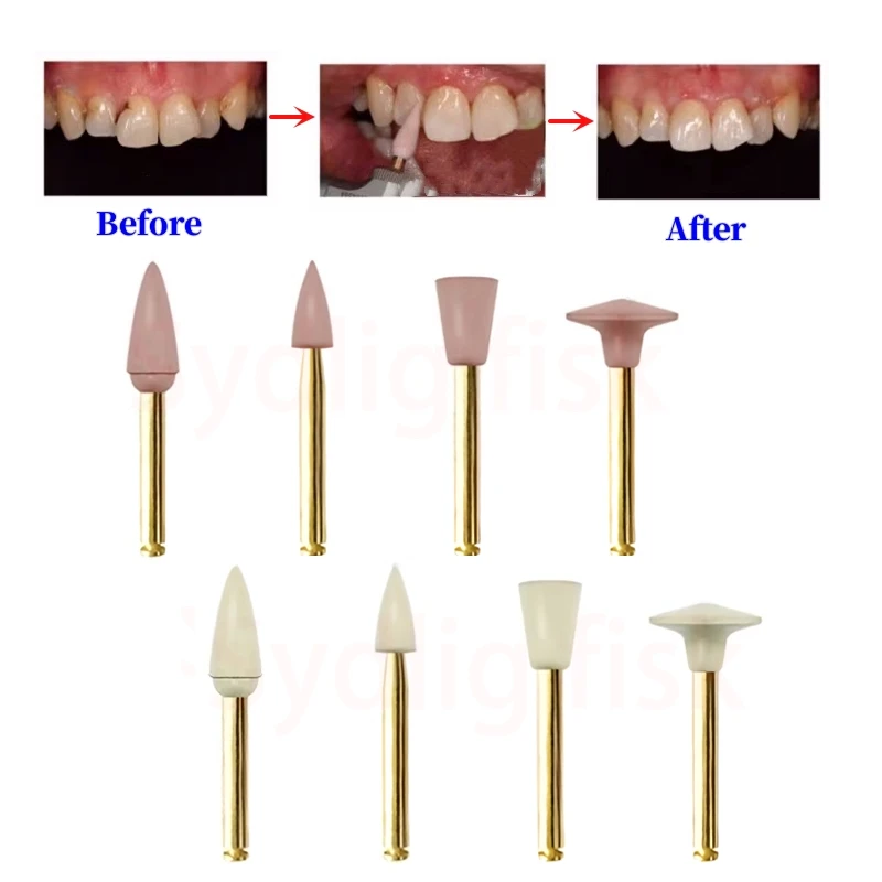 6/8pcs Dental Gummi polierer Verbund harz Poliers chleifkopf Diamant Poliers cheibe Rad Kit Spiral Flex Bürste Zahnarzt – Detail 2