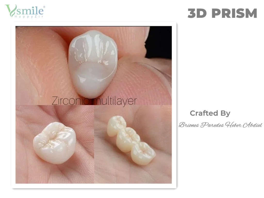 98/95/Amann 3D Prisma Multilayer Zirkonia Block Prothese 1200MPA 43-57% CADCAM Zirkonoxid Disc für Dental Labor Crown Long Bridge – Detail 6