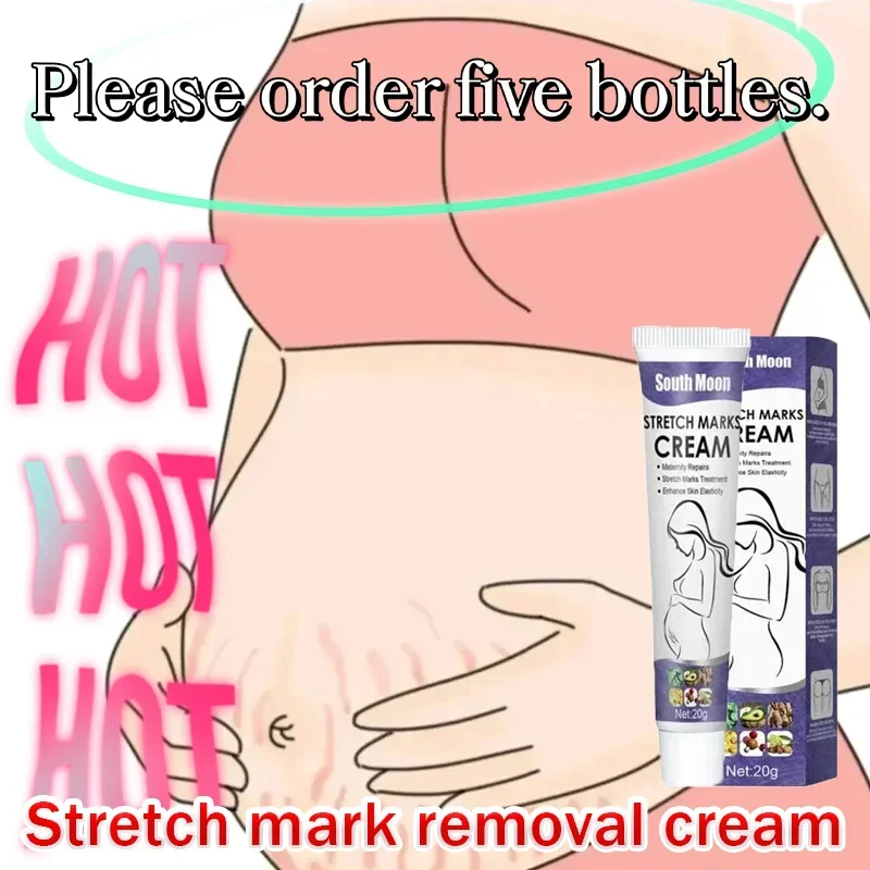 Gentle Skin Care Improves Elasticity Effective After Pregnancy Stretch Marks Removal Powerful Maternity Cream Nourishes Skin 4