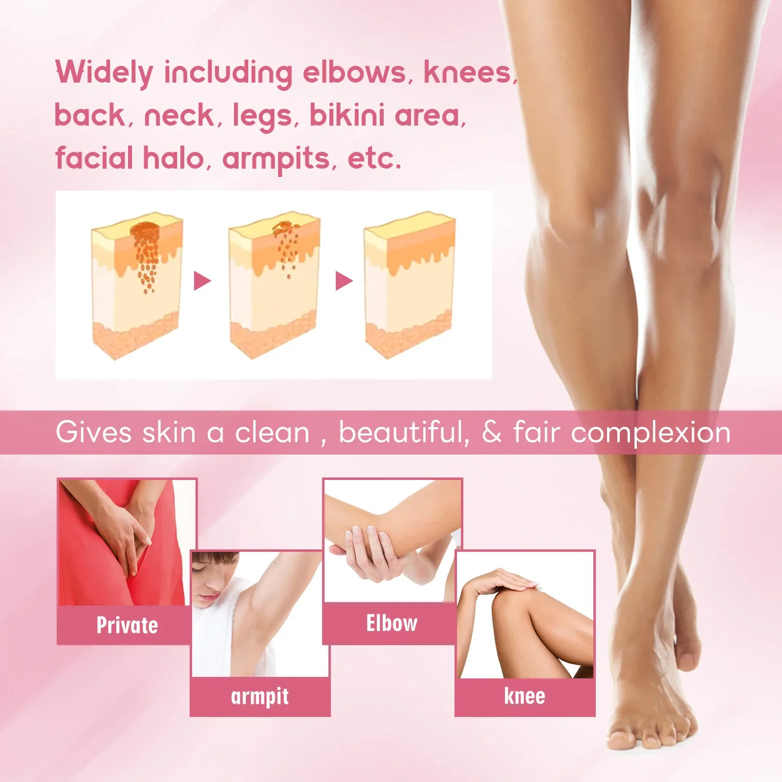 Körper-Bleaching-Creme, erhellt dunkle intime Intimbereiche, Knie, Oberschenkel, inneres Gelenk, Bikini, entfernt Melanin, Achsel-Bleaching-Creme_voghion.com