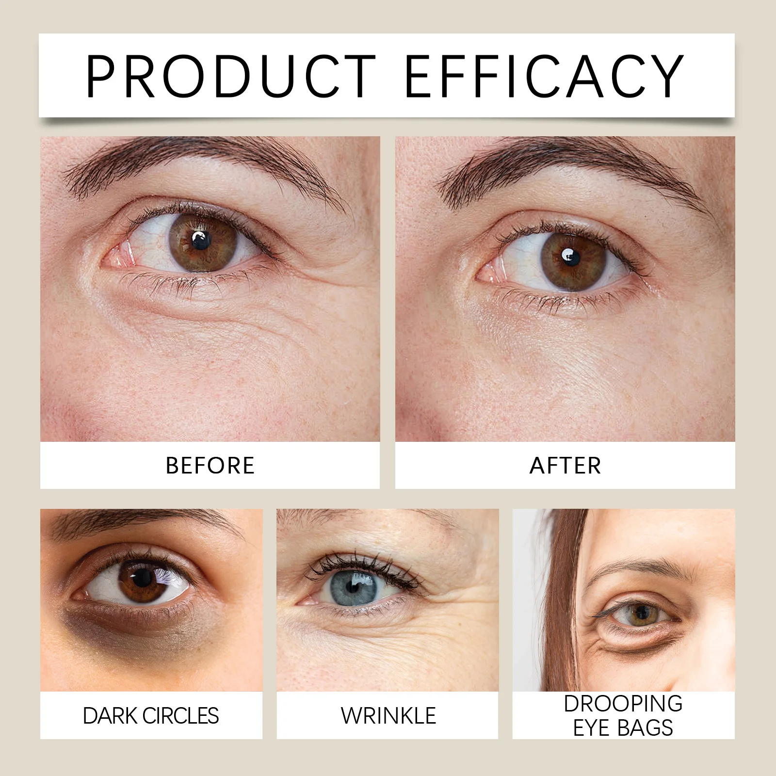 Firming Eye Roll-on Essential Oil Removal Dark Circles Wrinkle Lifting Repairing Eye Skin Moisturizing Hydrating Care 10ml