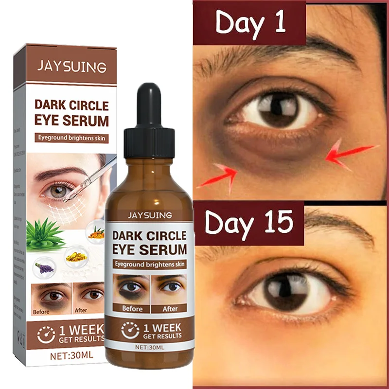 Remove Dark Circles Eye Serum Improve Eye Bags Lifting Firming Essence
