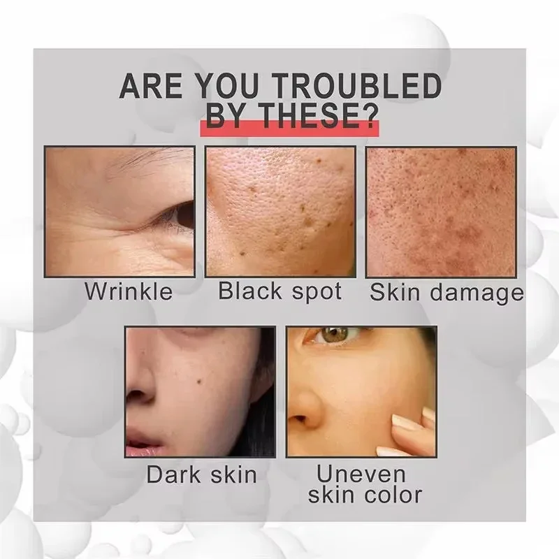 Powerful Dark Spots Remover Whitening Serum Face Freckle Melanin Correcting Anti Pigmentation Brighten Skin Beauty Care Essence 4