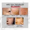 Powerful Dark Spots Remover Whitening Serum Face Freckle Melanin Correcting Anti Pigmentation Brighten Skin Beauty Care Essence 4