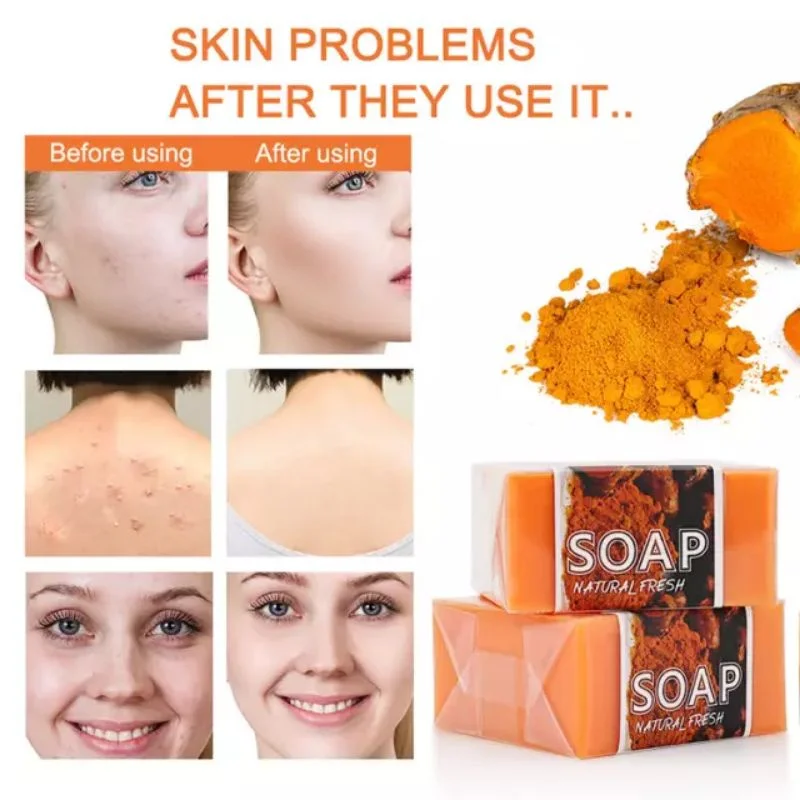 Turmeric Cleansing Soap, Handmade Ginger Essential Oil Bath, Anti-acne, Eliminate Pimples and Dark Spots