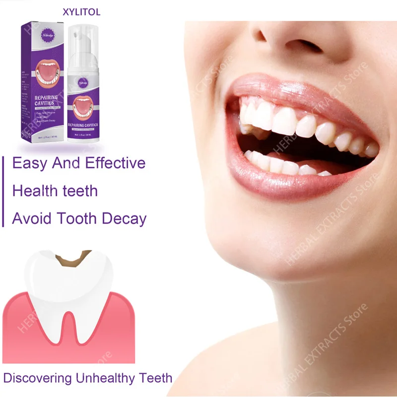 

Anti-cavity tooth decay fresh bad breath repair tooth decay remove plaque toothache relieve periodontitis