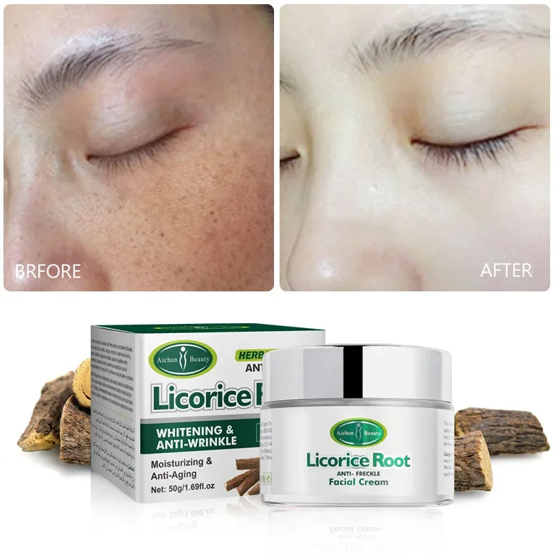 Licorice Root ANTI-FRECKLE Facial Cream Corrector Dark Spot Remover for Skin Care Arbutin Nicotinamide Face Skin Whitening Care