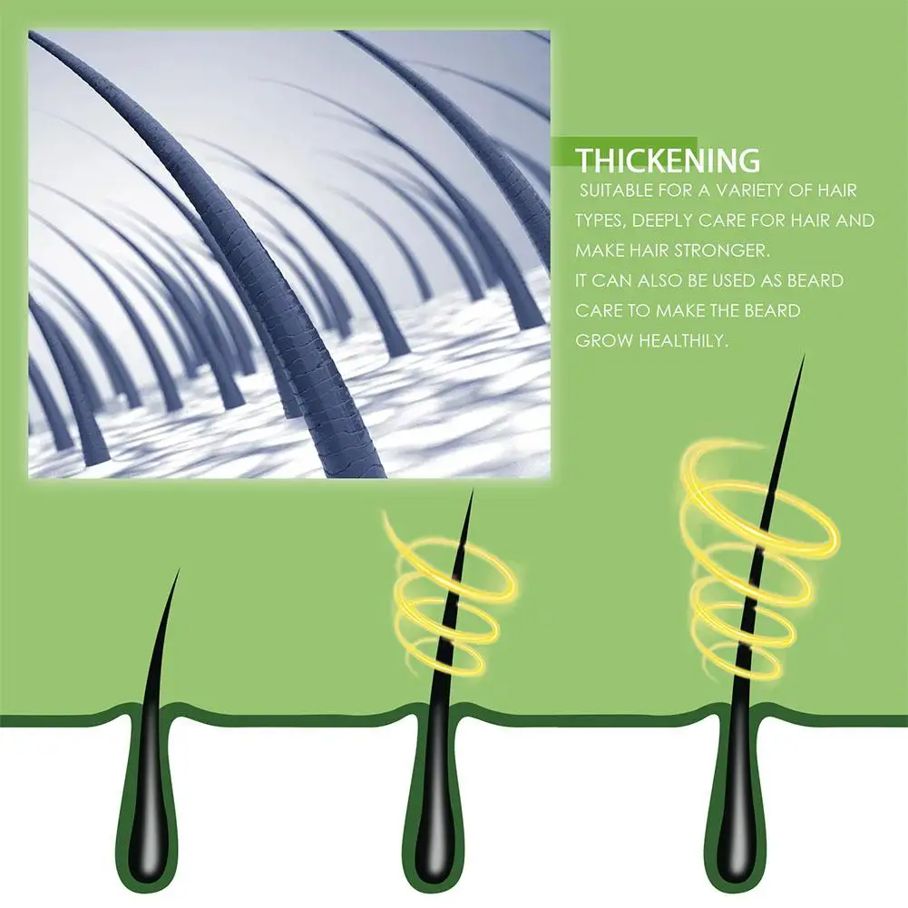 زيت إكليل الجبل النقي لفروة الرأس الجافة يحفز العن...