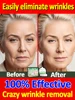 Wrinkles disappear Become beautiful now 1