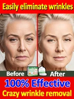 Wrinkles disappear Become beautiful now 1